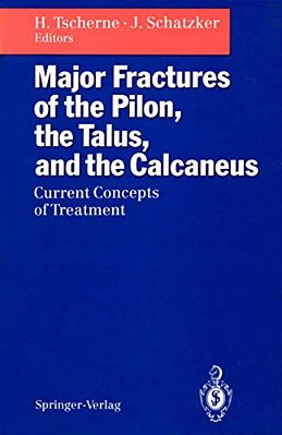 Major Fractures Of The Pilon, The Talus, And The Calcaneus: Current Concepts Of Treatment-..
