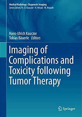 Imaging Of Complications And Toxicity Following Tumor Therapy-..