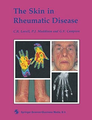 The Skin In Rheumatic Disease-..