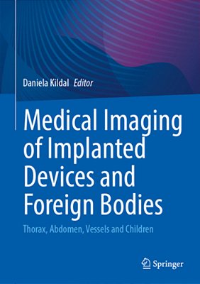 Medical Imaging Of Implanted Devices And Foreign Bodies: Thorax, Abdomen, Vessels And Children-..