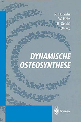 Dynamische Osteosynthese-..