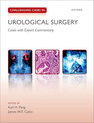 Challenging Cases In Urological Surgery-..