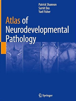 Atlas Of Neurodevelopmental Pathology-..
