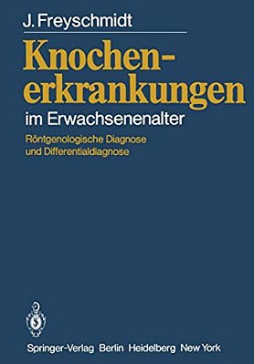 Knochenerkrankungen Im Erwachsenenalter: Röntgenologische Diagnose Und Differentialdiagnose-..
