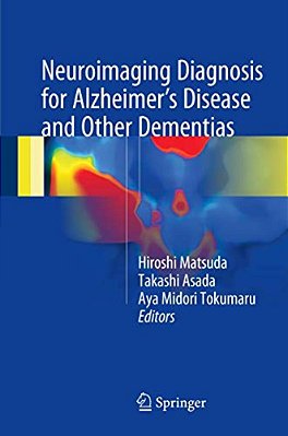 Neuroimaging Diagnosis For Alzheimer's Disease And Other Dementias-..