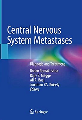 Central Nervous System Metastases: Diagnosis And Treatment-..