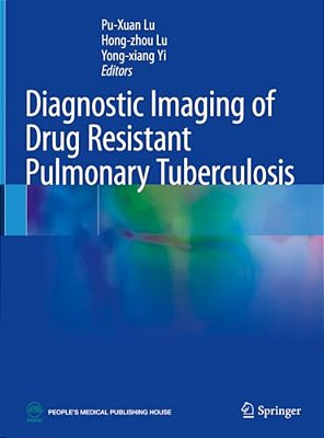 Diagnostic Imaging Of Drug Resistant Pulmonary Tuberculosis-..