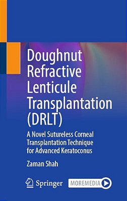 Doughnut Refractive Lenticule Transplantation (Drlt): A Novel Sutureless Corneal Transplantation Technique For Advanced Keratoconus-..