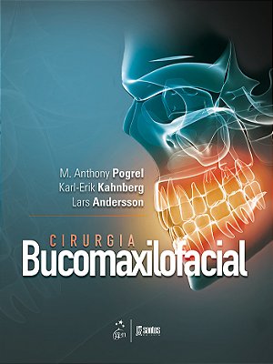 Cirurgia Bucomaxilofacial
