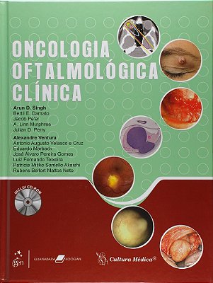 Oncologia Oftalmológica Clínica