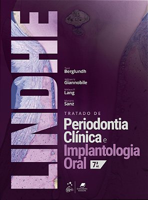Tratado De Periodontia Clinica E Implantologia Oral