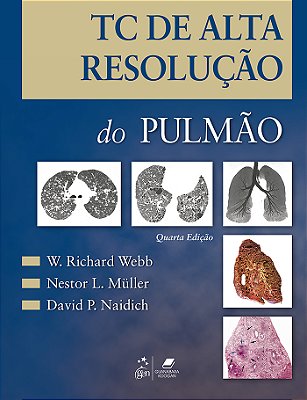 Tc De Alta Resolução Do Pulmão