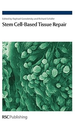 Stem Cell-Based Tissue Repair-..