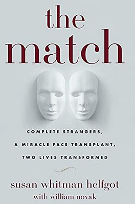 The Match: Complete Strangers, A Miracle Face Transplant, Two Lives Transformed-..