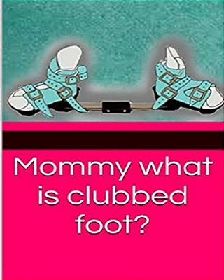 Mommy What Is Clubbed Foot?-..