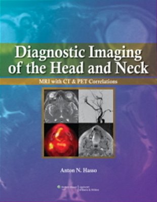 Diagnostic Imaging Of The Head And Neck-..