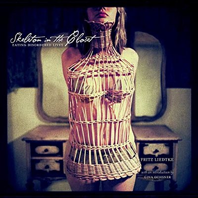 Skeleton In The Closet: Eating Disordered Lives-..