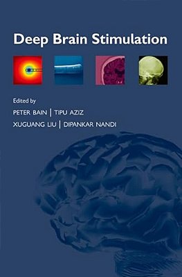 Deep Brain Stimulation-..