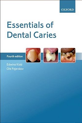 Essentials Of Dental Caries 4E P-..