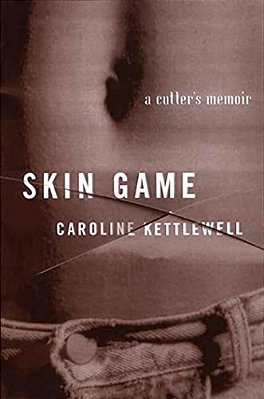 Skin Game: A Memoir-..