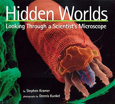 Hidden Worlds: Looking Through A Scientist's Microscope-..