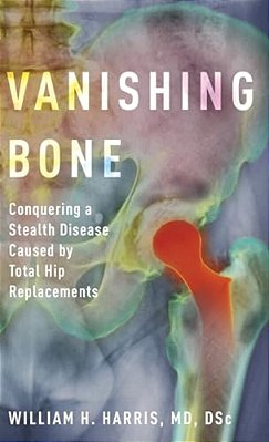 Vanishing Bone: Conquering A Stealth Disease Caused By Total Hip Replacements-..