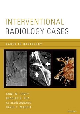 Interventional Radiology Cases-..