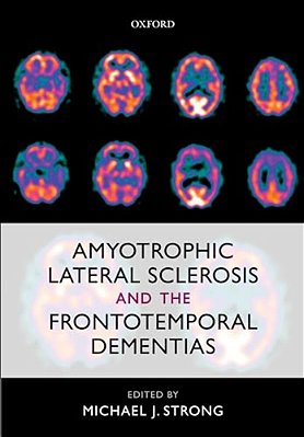 Amyotrophic Lateral Sclerosis And The Frontotemporal Dementias-..