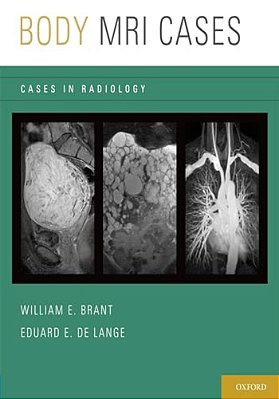Body Mri Cases-..