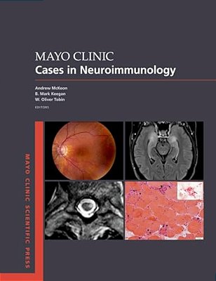 Mayo Clinic Cases In Neuroimmunology-..