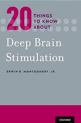 20 Things To Know About Deep Brain Stimulation-..