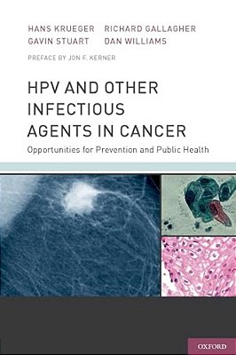 Hpv And Other Infectious Agents In Cancer: Opportunities For Prevention And Public Health-..