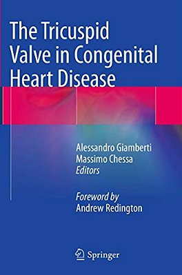 The Tricuspid Valve In Congenital Heart Disease-..