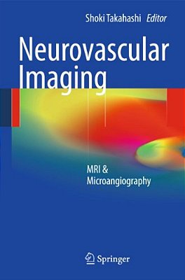 Neurovascular Imaging: Mri & Microangiography-..
