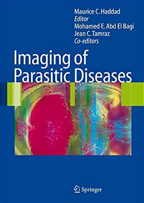 Imaging Of Parasitic Diseases-..