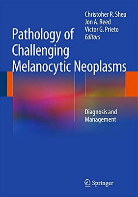 Pathology Of Challenging Melanocytic Neoplasms: Diagnosis And Management-..