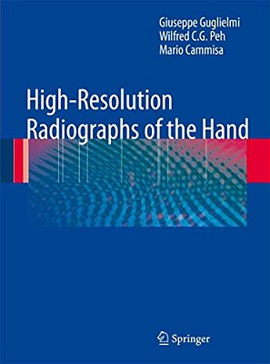 High-Resolution Radiographs Of The Hand-..