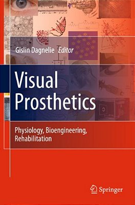 Visual Prosthetics: Physiology, Bioengineering, Rehabilitation-..