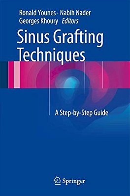 Sinus Grafting Techniques: A Step-By-step Guide-..