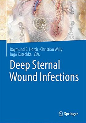 Deep Sternal Wound Infections-..