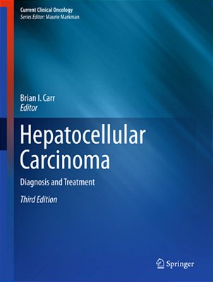 Hepatocellular Carcinoma: Diagnosis And Treatment-..