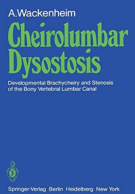Cheirolumbar Dysostosis: Developmental Brachycheiry And Stenosis Of The Bony Vertebral Lumbar Canal-..