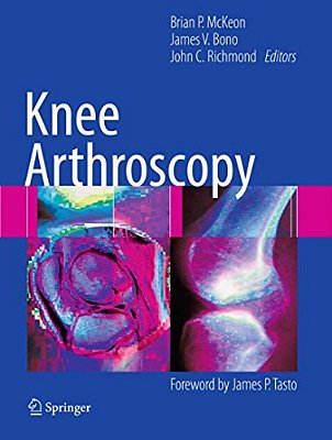 Knee Arthroscopy-..
