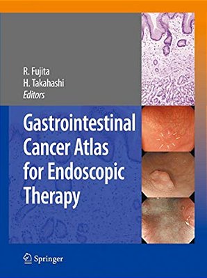 Gastrointestinal Cancer Atlas For Endoscopic Therapy-..