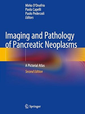 Imaging And Pathology Of Pancreatic Neoplasms: A Pictorial Atlas-..