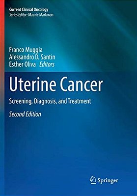 Uterine Cancer: Screening, Diagnosis, And Treatment-..