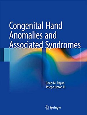 Congenital Hand Anomalies And Associated Syndromes-..