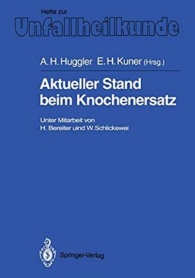 Aktueller Stand Beim Knochenersatz-..