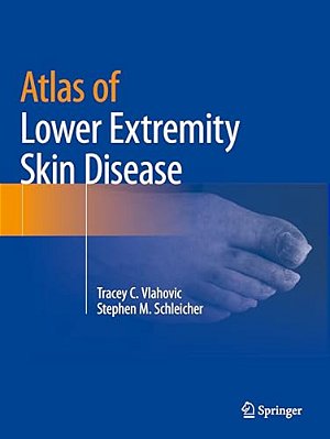 Atlas Of Lower Extremity Skin Disease-..