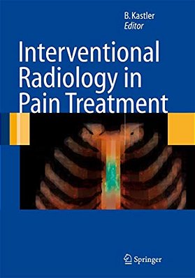 Interventional Radiology In Pain Treatment-..